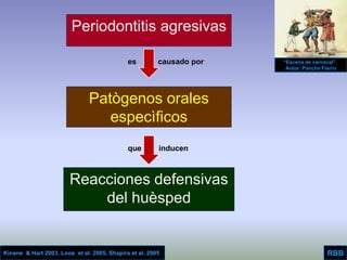 Aggressive Periodontitis
