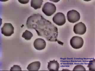 Aggressive Periodontitis