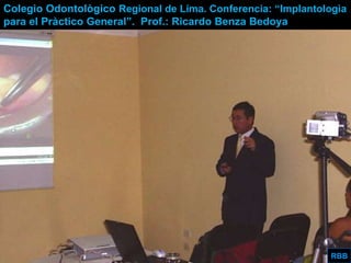 Aggressive Periodontitis