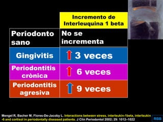 Aggressive Periodontitis
