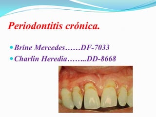 Periodontitis crónica.

 Brine Mercedes……DF-7033
 Charlin Heredia……..DD-8668
 