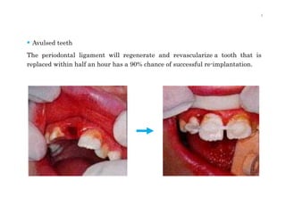 Periodontium | PPTX