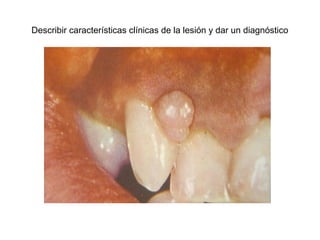 Describir características clínicas de la lesión y dar un diagnóstico
 
