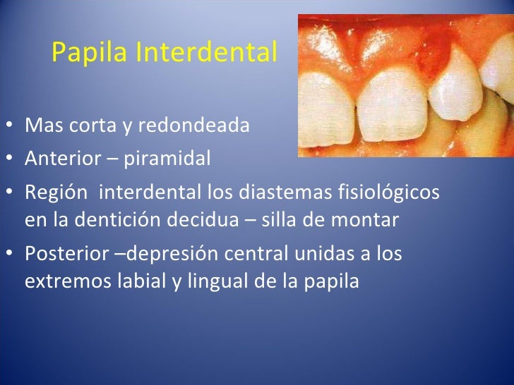 Periodonto e inervacion