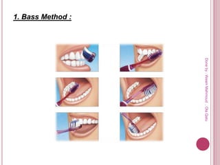 1. Bass Method :
Doneby:WeamMahmoud,OlaQatu
 