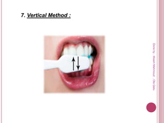 7. Vertical Method :
Doneby:WeamMahmoud,OlaQatu
 