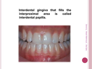 Interdental gingiva that fills the
interproximal area is called
interdental papilla.
Doneby:WeamMahmoud,OlaQatu
 