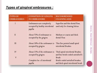Types of gingival embrasures :
Doneby:WeamMahmoud,OlaQatu
 