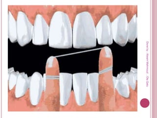 Doneby:WeamMahmoud,OlaQatu
 