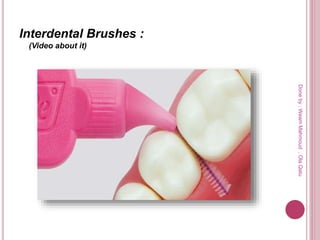 Interdental Brushes :
(Video about it)
Doneby:WeamMahmoud,OlaQatu
 