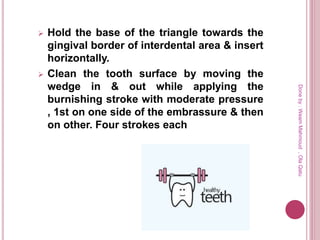  Hold the base of the triangle towards the
gingival border of interdental area & insert
horizontally.
 Clean the tooth surface by moving the
wedge in & out while applying the
burnishing stroke with moderate pressure
, 1st on one side of the embrassure & then
on other. Four strokes each
Doneby:WeamMahmoud,OlaQatu
 
