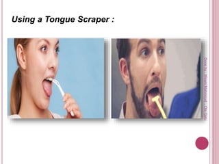 Using a Tongue Scraper :
Doneby:WeamMahmoud,OlaQatu
 