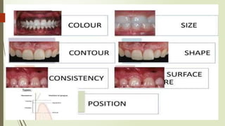 periodontology lecture 366777777777.pptx