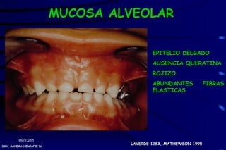 MUCOSA ALVEOLAR


                                           EPITELIO DELGADO
                                           AUSENCIA QUERATINA
                                           ROJIZO
                                           ABUNDANTES             FIBRAS
                                           ELASTICAS




         09/23/11
                                   LAVERDE 1983, MATHEWSON 1995
DRA. SANDRA HINCAPIE N.
 