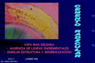 • CAPA MAS DELGADA
      • AUSENCIA DE LINEAS INCREMENTALES
    • SIMILAR ESTRUCTURA Y MINERALIZACION

         09/23/11         LAVERDE 1983
DRA. SANDRA HINCAPIE N.
 