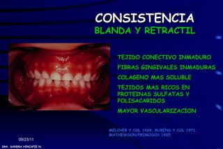 CONSISTENCIA
                          BLANDA Y RETRACTIL

                               TEJIDO CONECTIVO INMADURO
                               FIBRAS GINGIVALES INMADURAS
                               COLAGENO MAS SOLUBLE
                               TEJIDOS MAS RICOS EN
                               PROTEINAS SULFATAS Y
                               POLISACARIDOS
                               MAYOR VASCULARIZACION


                            MELCHER Y COL 1969, RUBENS Y COL 1971,
                            MATHEWSON/PRIMOSCH 1995
         09/23/11
DRA. SANDRA HINCAPIE N.
 