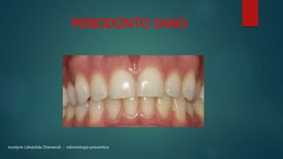PERIODONTO SANO
Jocelyne Labastida Otamendi : odontología preventiva
 