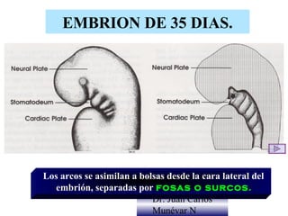 EMBRION DE 35 DIAS.




Los arcos se asimilan a bolsas desde la cara lateral del
  embrión, separadas por fosas o surcos.
                           Dr. Juan Carlos
                           Munévar N
 