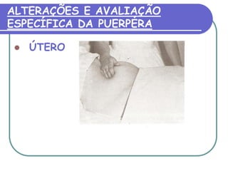ALTERAÇÕES E AVALIAÇÃO 
ESPECÍFICA DA PUERPÉRA 
 ÚTERO 
 
