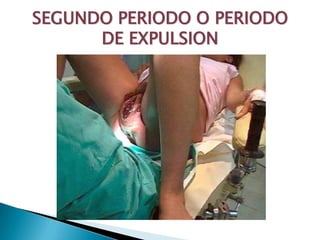 SEGUNDO PERIODO O PERIODO
      DE EXPULSION
 
