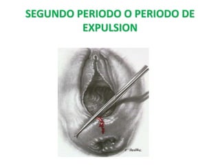 SEGUNDO PERIODO O PERIODO DE
         EXPULSION
 