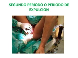 SEGUNDO PERIODO O PERIODO DE
         EXPULCION
 