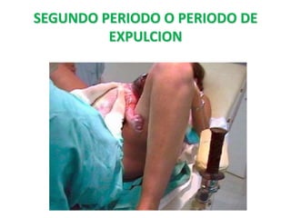 SEGUNDO PERIODO O PERIODO DE
         EXPULCION
 