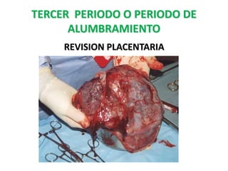 TERCER PERIODO O PERIODO DE
      ALUMBRAMIENTO
     REVISION PLACENTARIA
 