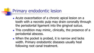 Primary endodontic lesion
 Acute exacerbation of a chronic apical lesion on a
tooth with a necrotic pulp may drain coronally through
the periodontal ligament into the gingival sulcus.
 This condition may mimic, clinically, the presence of a
periodontal abscess.
 When the pocket is probed, it is narrow and lacks
width. Primary endodontic diseases usually heal
following root canal treatment.
 