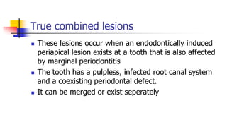 True combined lesions
 These lesions occur when an endodontically induced
periapical lesion exists at a tooth that is also affected
by marginal periodontitis
 The tooth has a pulpless, infected root canal system
and a coexisting periodontal defect.
 It can be merged or exist seperately
 