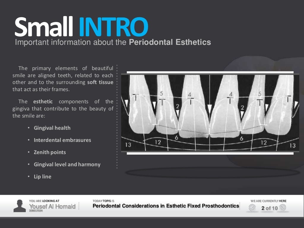 Periodontal Esthetic Considerations in Fixed Prosthodontics