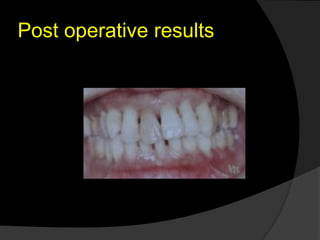 Post operative results
 