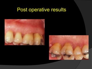 Post operative results
 