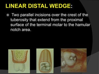 LINEAR DISTAL WEDGE:
 Two parallel incisions over the crest of the
tuberosity that extend from the proximal
surface of the terminal molar to the hamular
notch area.
 