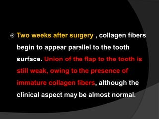  Two weeks after surgery , collagen fibers
begin to appear parallel to the tooth
surface. Union of the flap to the tooth is
still weak, owing to the presence of
immature collagen fibers, although the
clinical aspect may be almost normal.
 