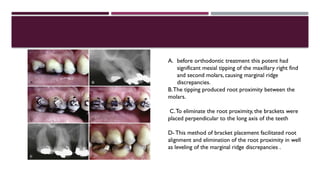 Periodontics and its importance in the dentistry | PPTX