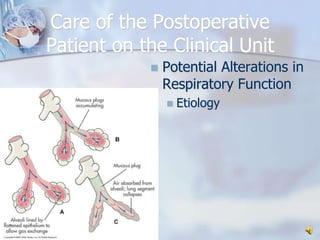 Care of the Postoperative Patient on the Clinical UnitPotential Alterations in Respiratory FunctionEtiology