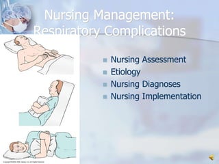 Nursing Management:Respiratory ComplicationsNursing AssessmentEtiologyNursing DiagnosesNursing Implementation