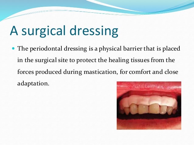 periodontal dressing