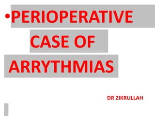 •PERIOPERATIVE
CASE OF
ARRYTHMIAS
DR ZIKRULLAH
 