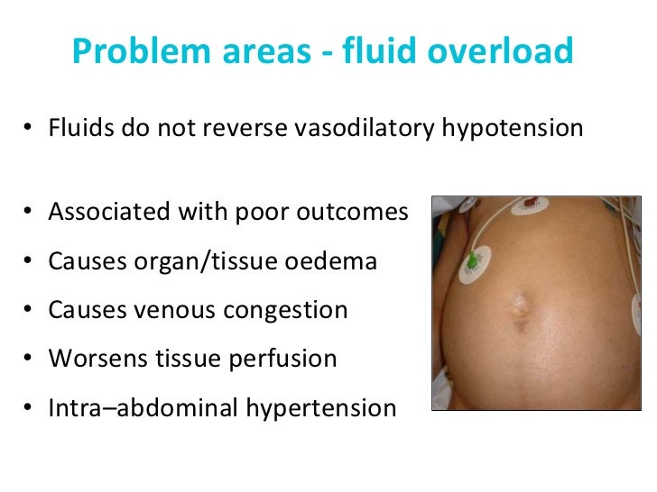 Perioperative acute kidney injury