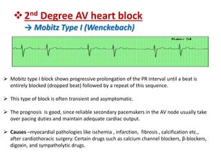 Type I Block Perioperative arrhythmias and acls gudelines | PPTX