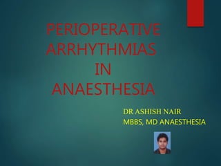 DR ASHISH NAIR
MBBS, MD ANAESTHESIA
PERIOPERATIVE
ARRHYTHMIAS
IN
ANAESTHESIA
 