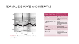 NORMAL ECG WAVES AND INTERVALS
 