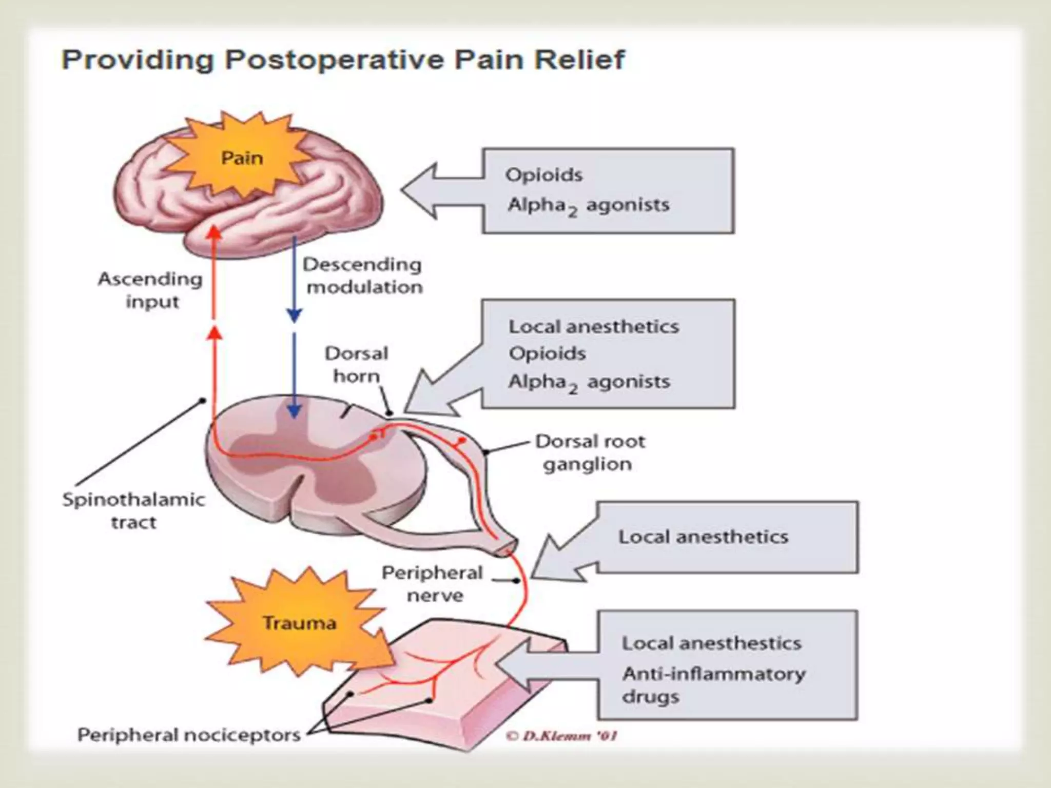 Perioperative pain management | PPTX
