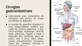 Cirurgias
gastrointestinais
■ Intervenção para tratamento de
infecções das partes do corpo
envolvidas na digestão;
■ A cirurgia do aparelho digestivo é
uma especialidade médica que
cuida do sistema digestivo, o que
inclui esôfago, estômago, vesícula
biliar, pâncreas, fígado e toda a
extensão dos intestinos além do
cólon, reto e ânus. Além disso,
realiza procedimentos cirúrgicos,
como por exemplo, hérnias e
 