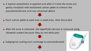 Comprehensive Overview and Treatment of Acute Necrotizing Ulcerative ...