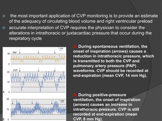 Perioprative monitoring | PPTX