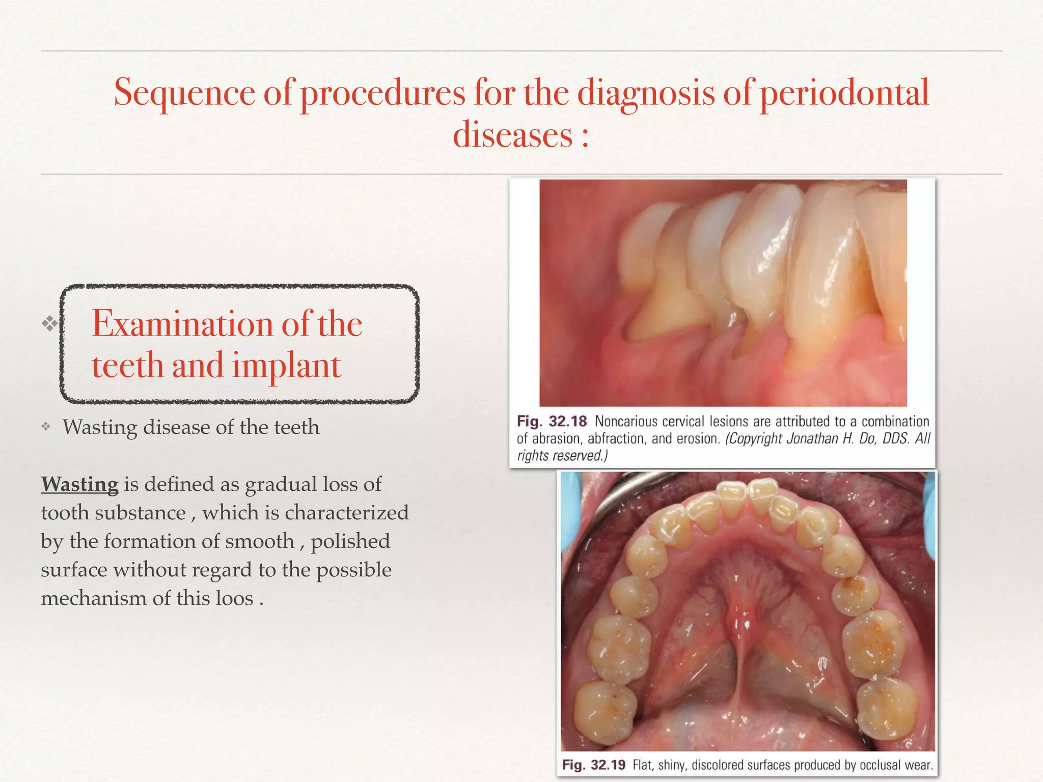 Sequence of procedures for the diagnosis of periodontal
diseases :
❖ Examination of the
teeth and implant
❖ Wasting disease of the teeth
Wasting is deﬁned as gradual loss of
tooth substance , which is characterized
by the formation of smooth , polished
surface without regard to the possible
mechanism of this loos .
 