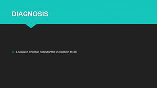 DIAGNOSIS
 Localized chronic periodontitis in relation to 36
 